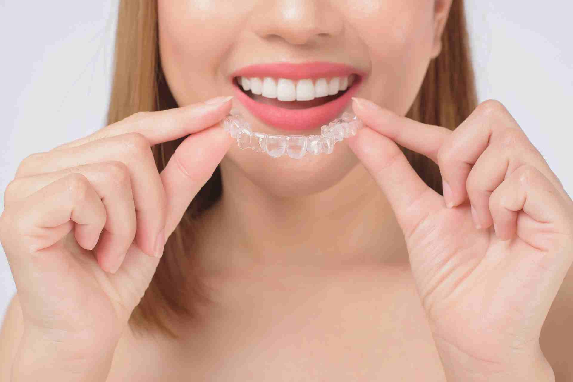 Right Image - 0-Pros and Cons of Invisalign